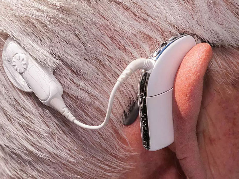  Laser light to your ears, cochlear implants can also be made in this way